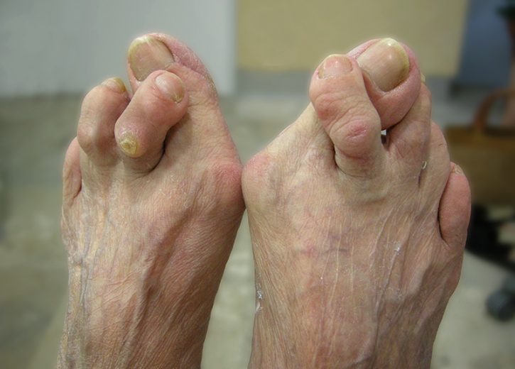 Podologia Geriatrica